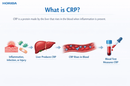 what-is-a-crp-test